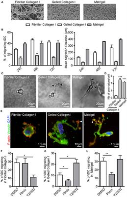 Podosomes, But Not the Maturation Status, Determine the Protease-Dependent 3D Migration in Human Dendritic Cells